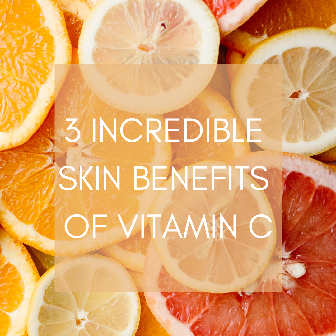 3 INCREDIBLE SKIN BENEFITS OF VITAMIN C